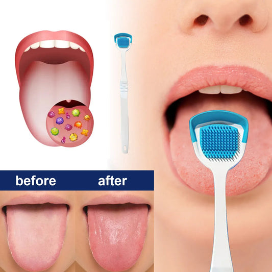 Tongue Cleaner Brush With Soft Silicone Bristles
